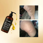 ANTI CELLULITE ™ | Aceite Anticelulitis❤️ + ENVIO GRATIS 🎁