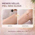 🌿 CYPERUS OIL™ 🌿 Aceite Depilatorio Natural + ENVIO GRATIS 🎁
