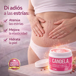 CANDELA™ ELIMINA CELULITIS Y ESTRÍAS 300 ML ❤️ + ENVIO GRATIS 🎁